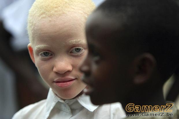 albinos-9.jpg